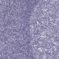 Invitrogen PIT1 Polyclonal Antibody 100 &mu;L; Unconjugated:Antibodies,