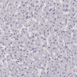 Invitrogen PIT1 Polyclonal Antibody 100 &mu;L; Unconjugated:Antibodies,