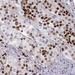 Invitrogen PIT1 Polyclonal Antibody 100 &mu;L; Unconjugated:Antibodies,