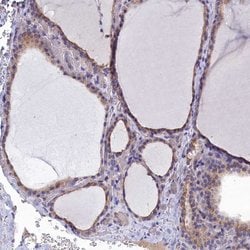 Invitrogen RABGAP1 Polyclonal Antibody 100 &mu;L; Unconjugated:Antibodies,