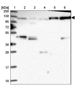 Invitrogen Coronin 7 Polyclonal Antibody 100 &mu;L; Unconjugated:Antibodies,