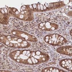 Invitrogen C19orf44 Polyclonal Antibody 100 &mu;L; Unconjugated:Antibodies,