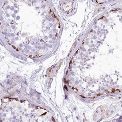 Invitrogen FTSJD1 Polyclonal Antibody 100 &mu;L; Unconjugated:Antibodies,
