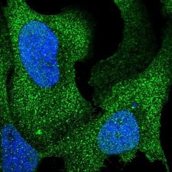 Invitrogen ARHGAP17 Polyclonal Antibody 100 &mu;L; Unconjugated:Antibodies,