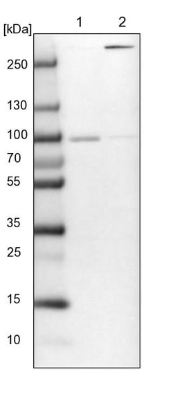 Invitrogen ARHGAP17 Polyclonal Antibody 100 &mu;L; Unconjugated:Antibodies,