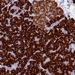 Invitrogen FKBP11 Polyclonal Antibody 100 &mu;L; Unconjugated:Antibodies,