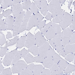 Invitrogen FKBP11 Polyclonal Antibody 100 &mu;L; Unconjugated:Antibodies,