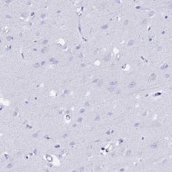 Invitrogen FKBP11 Polyclonal Antibody 100 &mu;L; Unconjugated:Antibodies,