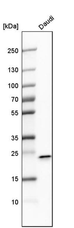 Invitrogen FKBP11 Polyclonal Antibody 100 &mu;L; Unconjugated:Antibodies,