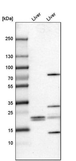 Invitrogen FKBP11 Polyclonal Antibody 100 &mu;L; Unconjugated:Antibodies,