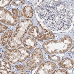 Invitrogen ZNF606 Polyclonal Antibody 100 &mu;L; Unconjugated:Antibodies,