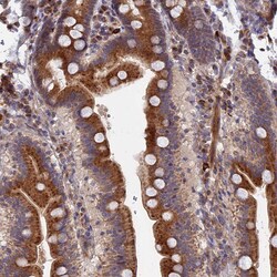 Invitrogen TRAPPC2L Polyclonal Antibody 100 &mu;L | Buy Online | Invitrogen&trade; | Fisher Scientific