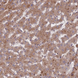 Invitrogen TRAPPC2L Polyclonal Antibody 100 &mu;L | Buy Online | Invitrogen&trade; | Fisher Scientific
