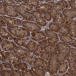 Invitrogen PCCA Polyclonal Antibody 100 &mu;L; Unconjugated:Antibodies,