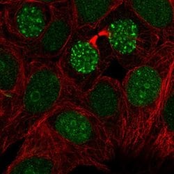 Invitrogen TIGD1 Polyclonal Antibody 100 &mu;L; Unconjugated:Antibodies,