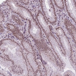 Invitrogen TIGD1 Polyclonal Antibody 100 &mu;L; Unconjugated:Antibodies,