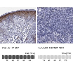 Invitrogen SULT2B1 Polyclonal Antibody 100 &mu;L | Buy Online | Invitrogen&trade; | Fisher Scientific