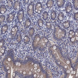 Invitrogen SULT2B1 Polyclonal Antibody 100 &mu;L | Buy Online | Invitrogen&trade; | Fisher Scientific