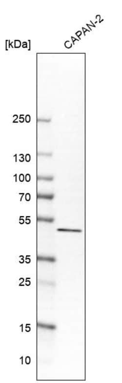 Invitrogen SULT2B1 Polyclonal Antibody 100 &mu;L | Buy Online | Invitrogen&trade; | Fisher Scientific