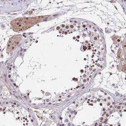 Invitrogen RBBP6 Polyclonal Antibody 100 &mu;L; Unconjugated:Antibodies,