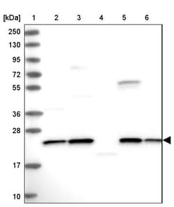 Invitrogen NPVF Polyclonal Antibody 100 &mu;L | Buy Online | Invitrogen&trade; | Fisher Scientific