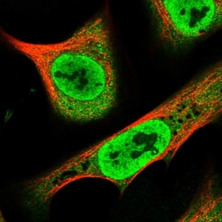 Invitrogen RPAP1 Polyclonal Antibody 100 &mu;L; Unconjugated:Antibodies,