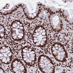 Invitrogen RPAP1 Polyclonal Antibody 100 &mu;L; Unconjugated:Antibodies,