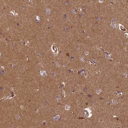 Invitrogen C6orf70 Polyclonal Antibody 100 &mu;L; Unconjugated:Antibodies,
