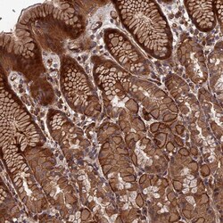 Invitrogen DEF8 Polyclonal Antibody 100 &mu;L; Unconjugated:Antibodies,