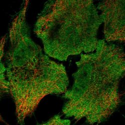 Invitrogen RRAD Polyclonal Antibody 100 &mu;L; Unconjugated:Antibodies,