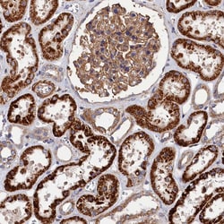 Invitrogen LDHD Polyclonal Antibody 100 &mu;L; Unconjugated:Antibodies,