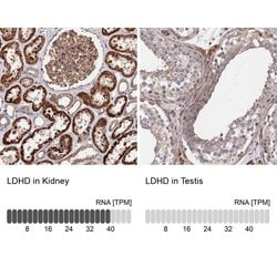 Invitrogen LDHD Polyclonal Antibody 100 &mu;L; Unconjugated:Antibodies,