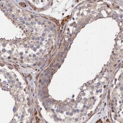 Invitrogen LDHD Polyclonal Antibody 100 &mu;L; Unconjugated:Antibodies,