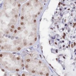 Invitrogen CT112 Polyclonal Antibody 100 &mu;L; Unconjugated:Anticorps,