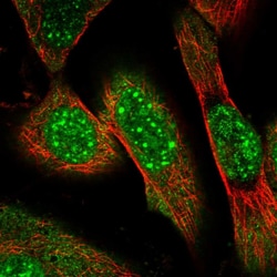 Invitrogen ZNF169 Polyclonal Antibody 100 &mu;L; Unconjugated:Antibodies,
