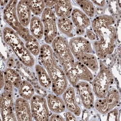Invitrogen ZNF169 Polyclonal Antibody 100 &mu;L; Unconjugated:Antibodies,