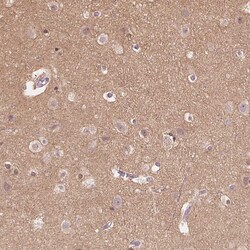 Invitrogen Cryptic Polyclonal Antibody 100 &mu;L; Unconjugated:Antibodies,