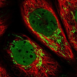 Invitrogen CARS2 Polyclonal Antibody 100 &mu;L | Buy Online | Invitrogen&trade; | Fisher Scientific