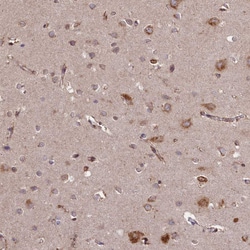 Invitrogen SLC38A7 Polyclonal Antibody 100 &mu;L; Unconjugated:Antibodies,