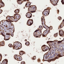 Invitrogen SLC38A7 Polyclonal Antibody 100 &mu;L; Unconjugated:Antibodies,