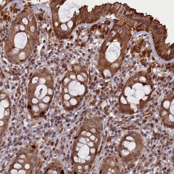 Invitrogen SLC38A7 Polyclonal Antibody 100 &mu;L; Unconjugated:Antibodies,