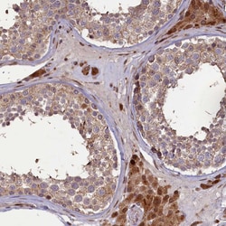 Invitrogen SLC38A7 Polyclonal Antibody 100 &mu;L; Unconjugated:Antibodies,