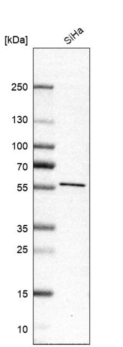 Invitrogen SLC38A7 Polyclonal Antibody 100 &mu;L | Buy Online | Invitrogen&trade; | Fisher Scientific