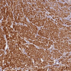 Invitrogen FUZ Polyclonal Antibody 100 &mu;L; Unconjugated:Antibodies,
