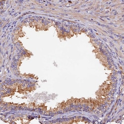 Invitrogen CLN5 Polyclonal Antibody 100 &mu;L; Unconjugated:Antibodies,