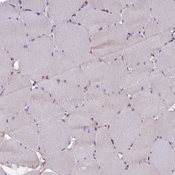 Invitrogen CLN5 Polyclonal Antibody 100 &mu;L; Unconjugated:Antibodies,