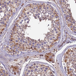 Invitrogen CLN5 Polyclonal Antibody 100 &mu;L; Unconjugated:Antibodies,