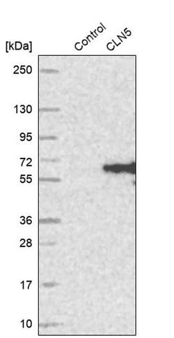 Invitrogen CLN5 Polyclonal Antibody 100 &mu;L; Unconjugated:Antibodies,