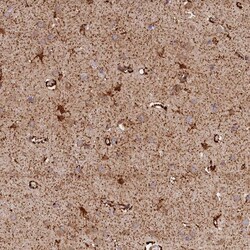 Invitrogen AKTIP Polyclonal Antibody 100 &mu;L; Unconjugated:Antibodies,