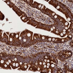 Invitrogen AKTIP Polyclonal Antibody 100 &mu;L; Unconjugated:Antibodies,